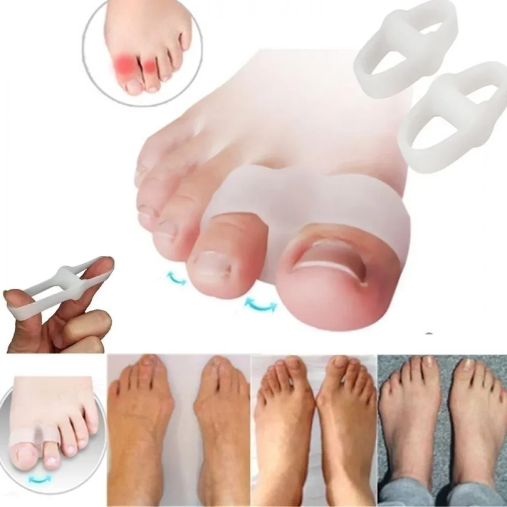 2 Holes Bunion Corrector Pain  - Correction Fluid White recension och pris